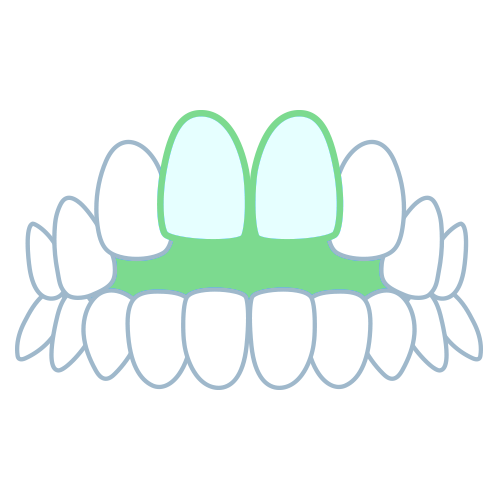開咬