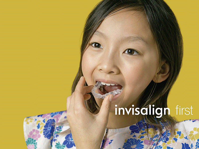 インビザライン・ファースト矯正