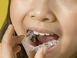 透明なマウスピースで目立ちにくい